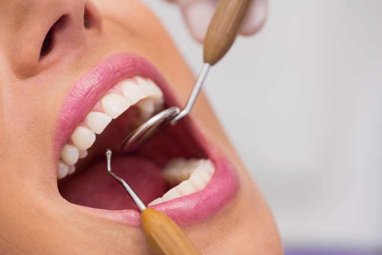 dentist-examining-female-patient-teeth-min