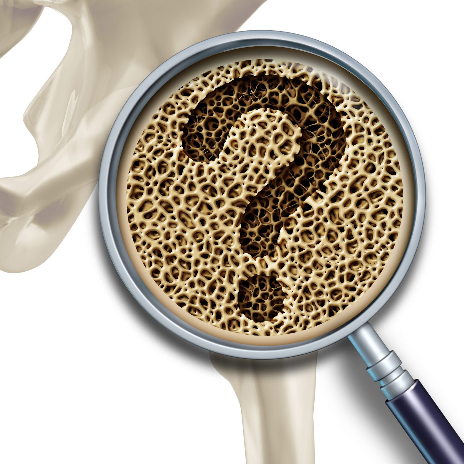 Bone medical health questions and osteoporosis illustration concept as a close up diagram of the inside of human skeletal hip bones with a magnification glass showing a normal healthy condition degrading to abnormal unhealthy anatomy as a question mark.